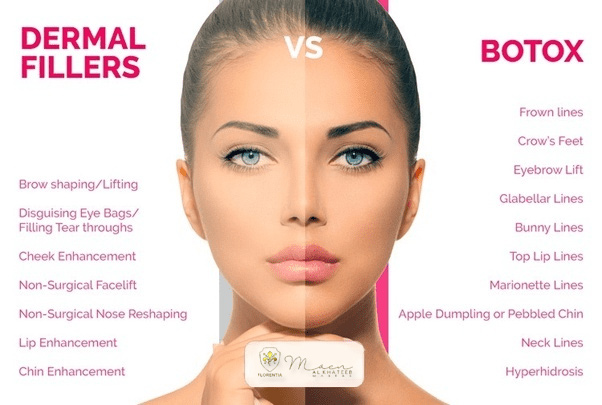botox vs fillers